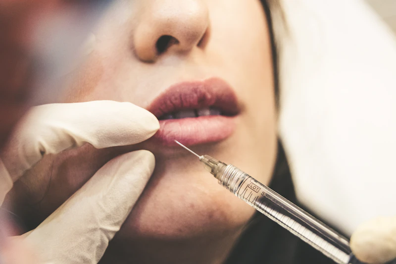Botox e preenchimento